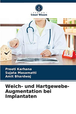 Weich- und Hartgewebe-Augmentation bei Implantaten (German Edition)