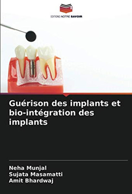 Guérison des implants et bio-intégration des implants (French Edition)