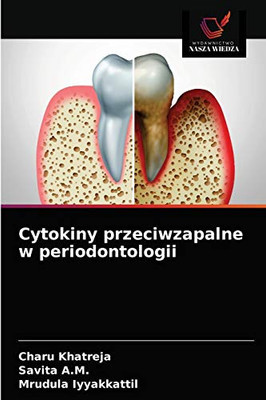 Cytokiny przeciwzapalne w periodontologii (Polish Edition)