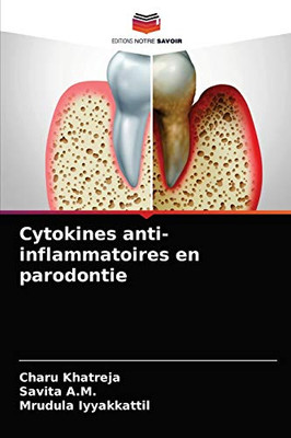 Cytokines anti-inflammatoires en parodontie (French Edition)