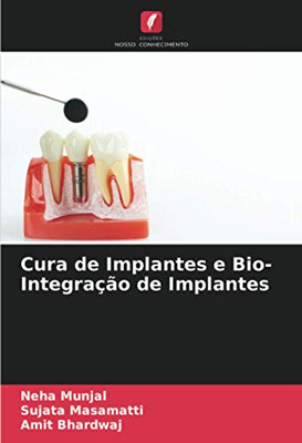 Cura de Implantes e Bio- Integração de Implantes (Portuguese Edition)