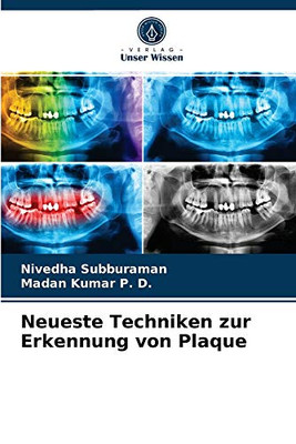 Neueste Techniken zur Erkennung von Plaque (German Edition)