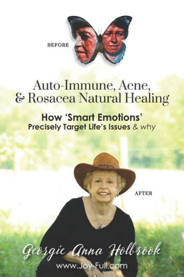 Auto-Immune, Acne, & Rosacea Natural Healing - How 'smart Emotions' Precisely Target Life's Issues & Why
