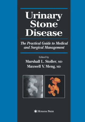 Urinary Stone Disease: The Practical Guide To Medical And Surgical Management (Current Clinical Urology)