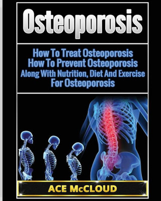 Osteoporosis: How To Treat Osteoporosis: How To Prevent Osteoporosis: Along With Nutrition, Diet And Exercise For Osteoporosis (Reverse Or Prevent Bone Loss From Osteoporosis All)