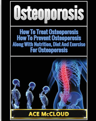 Osteoporosis: How To Treat Osteoporosis: How To Prevent Osteoporosis: Along With Nutrition, Diet And Exercise For Osteoporosis (Reverse Or Prevent Bone Loss From Osteoporosis All)