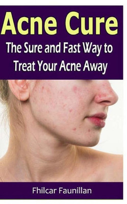 Acne Cure: The Sure And Fast Way To Treat Your Acne Away