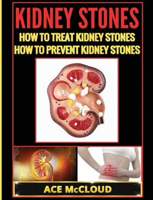 Kidney Stones: How To Treat Kidney Stones: How To Prevent Kidney Stones (Kidney Stone Treatment & Prevention Guide With All)