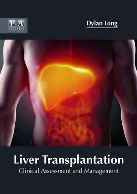 Liver Transplantation: Clinical Assessment And Management