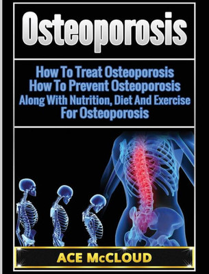 Osteoporosis: How To Treat Osteoporosis: How To Prevent Osteoporosis: Along With Nutrition, Diet And Exercise For Osteoporosis (Reverse Or Prevent Bone Loss From Osteoporosis All)