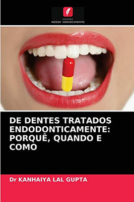 de Dentes Tratados Endodonticamente: Porquê, Quando E Como (Portuguese Edition)