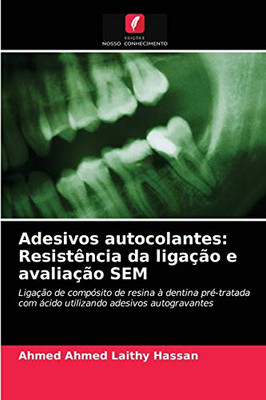 Adesivos autocolantes: Resistência da ligação e avaliação SEM (Portuguese Edition)