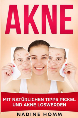 Akne: Mit natUrlichen Tipps Pickel und Akne loswerden (German Edition)