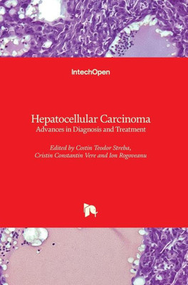 Hepatocellular Carcinoma - Advances in Diagnosis and Treatment
