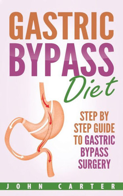 Gastric Bypass Diet: Step By Step Guide to Gastric Bypass Surgery (Bariatric Cookbook)