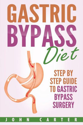 Gastric Bypass Diet: Step By Step Guide to Gastric Bypass Surgery (Bariatric Cookbook)