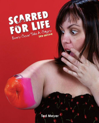 Scarred For Life. 2Nd Edition : Every Scar Tells A Story