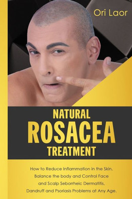 Natural Rosacea Treatment : How To Reduce Inflammation In The Skin, Balance The Body And Control Face And Scalp Seborrheic Dermatitis, Dandruff And Psoriasis Problems At Any Age.