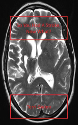 So You Had A Stroke : Now What?