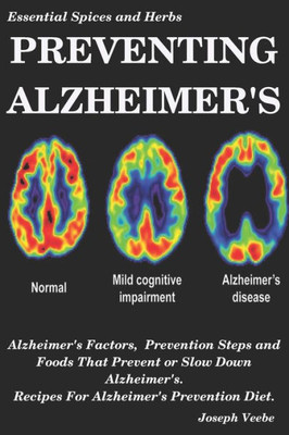 Preventing Alzheimer'S : Alzheimer'S Factors, Prevention Steps And Foods That Prevent Or Slow Alzheimer'S, Recipes For Alzheimer'S Prevention Diet