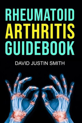 Rheumatoid Arthritis Guidebook