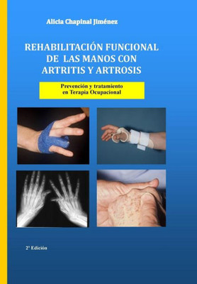 Rehabilitación Funcional De Las Manos Con Artritis Y Artrosis : Prevención Y Tratamiento