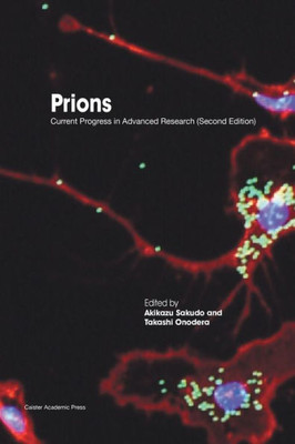 Prions : Current Progress In Advanced Research