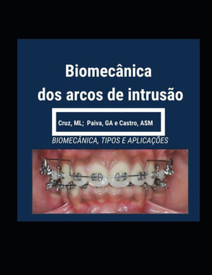 Biomecânica Dos Arcos De Intrusão (Portuguese Edition)