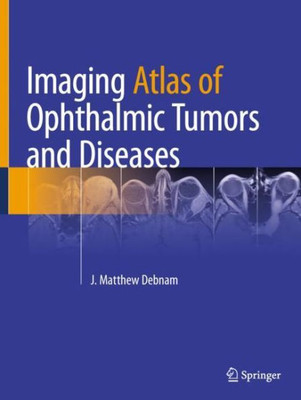 Imaging Atlas Of Ophthalmic Tumors And Diseases