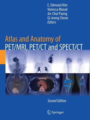 Atlas And Anatomy Of Pet/Mri, Pet/Ct And Spect/Ct