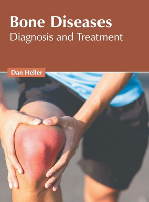 Bone Diseases: Diagnosis and Treatment