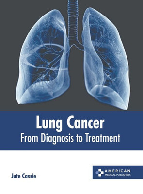 Lung Cancer: From Diagnosis to Treatment