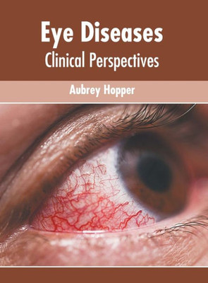 Eye Diseases: Clinical Perspectives