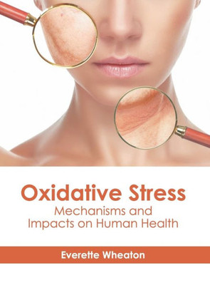 Oxidative Stress: Mechanisms and Impacts on Human Health