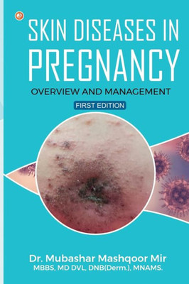 Skin Diseases in Pregnancy: Overview and Management