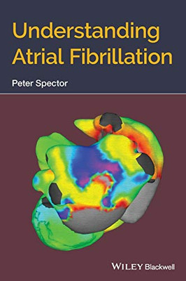 Understanding Atrial Fibrillation