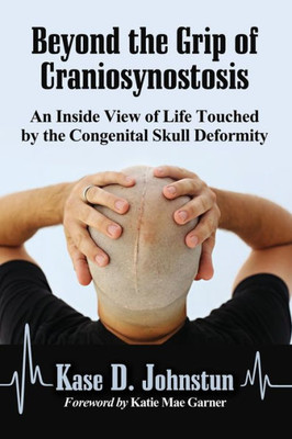 Beyond The Grip Of Craniosynostosis: An Inside View Of Life Touched By The Congenital Skull Deformity