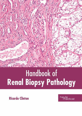 Handbook Of Renal Biopsy Pathology