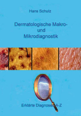 Dermatologische Makro- Und Mikrodiagnostik: Erklärte Diagnosen A-Z (German Edition)