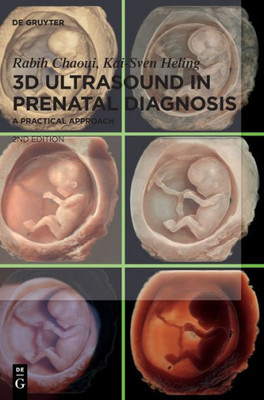 3D Ultrasound in Prenatal Diagnosis : A Practical Approach