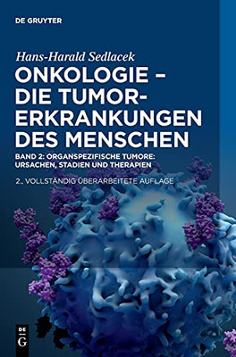 Oganspezifische Tumore: Ursachen, Stadien Und Therapien (German Edition)