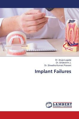 Implant Failures