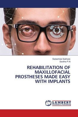 Rehabilitation of Maxillofacial Prostheses Made Easy with Implants