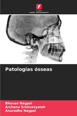 Patologias ósseas Patologias ósseas