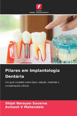 Pilares em Implantologia Dentária