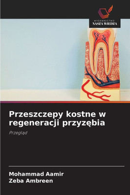 Przeszczepy kostne w regeneracji przyzębia Przeszczepy kostne w regeneracji przyzębia