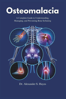 Osteomalacia: A Complete Guide to Understanding, Managing, and Preventing Bone Softening