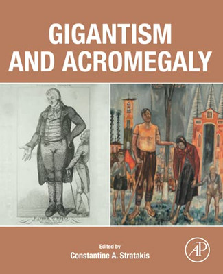 Gigantism And Acromegaly: Genetics, Diagnosis, And Treatment
