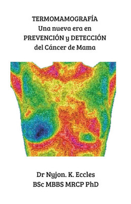 TermomamografÃ­a: Una nueva era en PREVENCIÃ“N y DETECCIÃ“N del CÃ¡ncer de Mama
