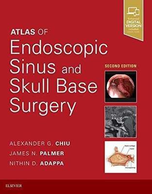 Atlas Of Endoscopic Sinus And Skull Base Surgery